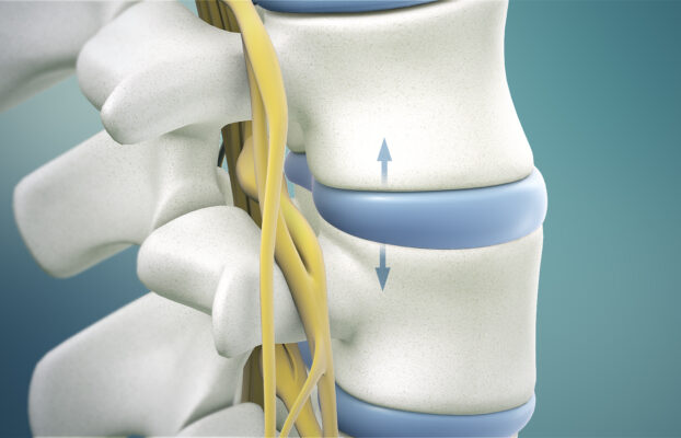 Benefits of Spinal Decompression Therapy For Disc Injuries