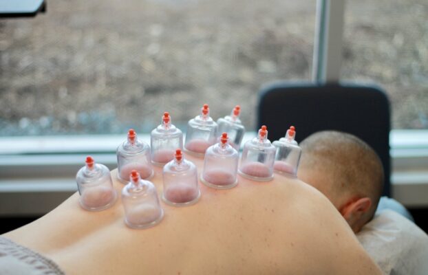 Cupping, Dry Needling & Graston: Alternative Therapies That Work