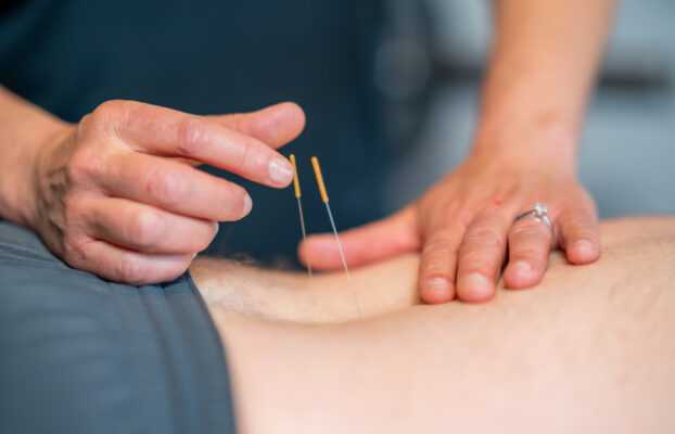 Dry Needling for Pain Relief: How It Enhances Chiropractic Care, Physical Therapy, and Regenerative Treatments