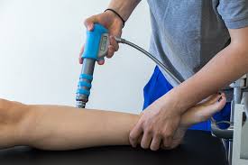 Shockwave Therapy: Innovative Non-Surgical Treatment That Works