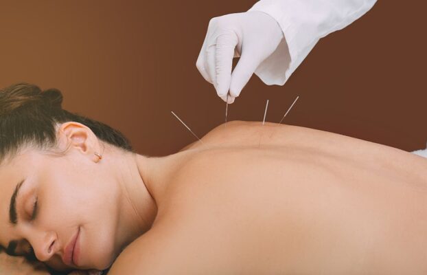 Dry Needling Specialists – Elite Spine Houston & Spring: Your Complete Guide to Pain Relief, Muscle Recovery, and Restored Mobility