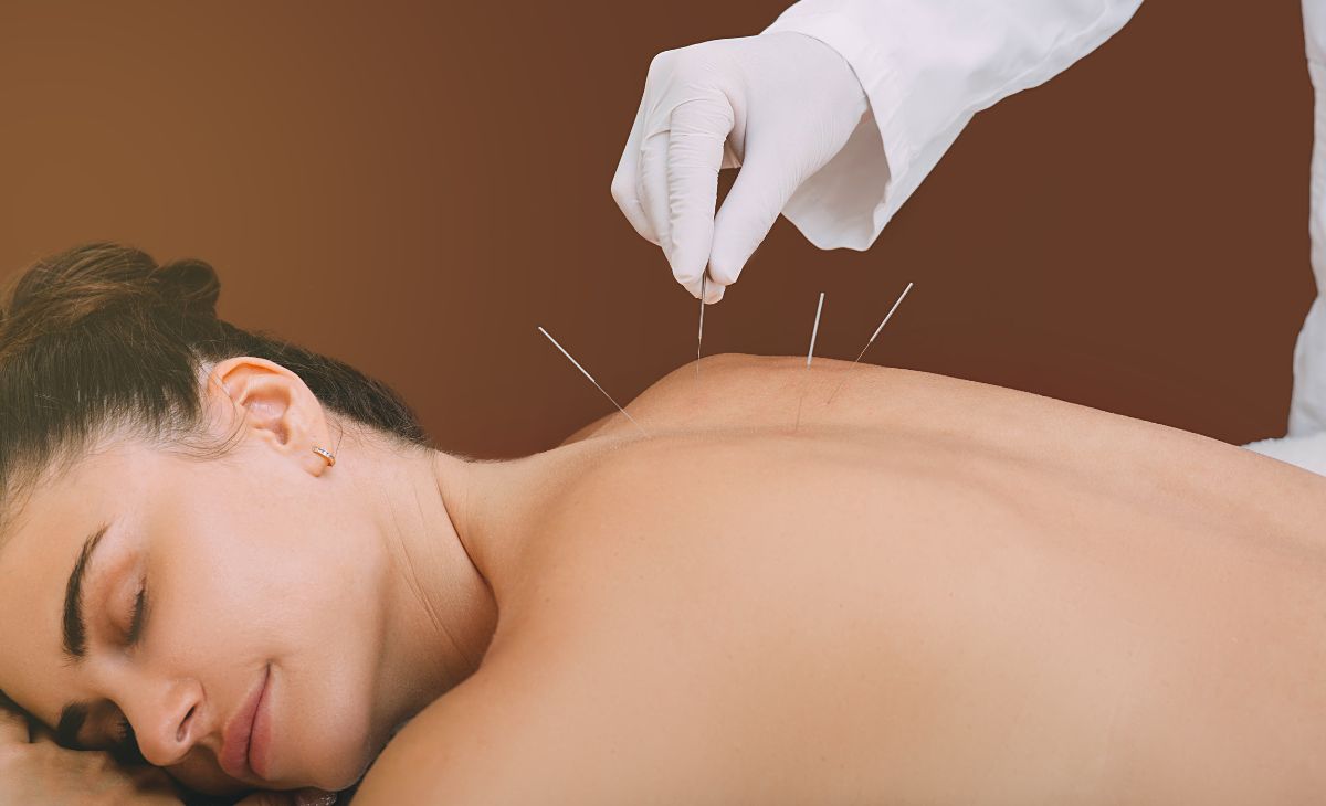 Dry Needling Specialists – Elite Spine Houston & Spring: Your Complete Guide to Pain Relief, Muscle Recovery, and Restored Mobility