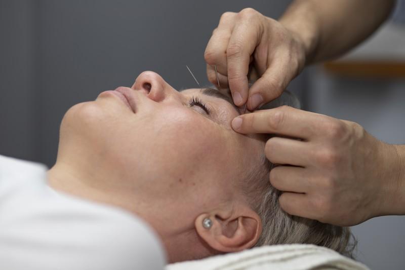 japanese-traditional-medicine-with-needles_26412479
