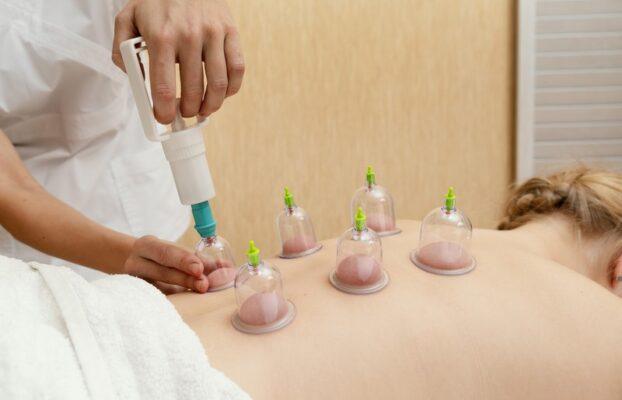 What to Expect During a Cupping Therapy Session