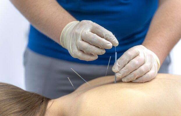 Dry Needling for Pain Relief: How It Enhances Chiropractic Care, Physical Therapy, and Regenerative Treatments