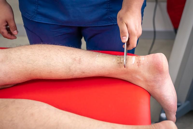 Scrape Away Your Sports Injury With the Graston Technique