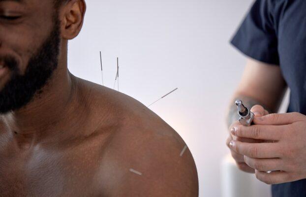 Dry Needling Specialists – Elite Spine Houston & Spring: Your Complete Guide to Pain Relief, Muscle Recovery, and Restored Mobility