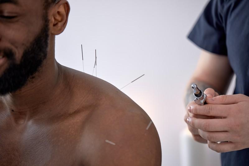 Dry Needling Specialists – Elite Spine Houston & Spring: Your Complete Guide to Pain Relief, Muscle Recovery, and Restored Mobility