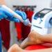 physical-therapy-foot-with-acoustic-shock