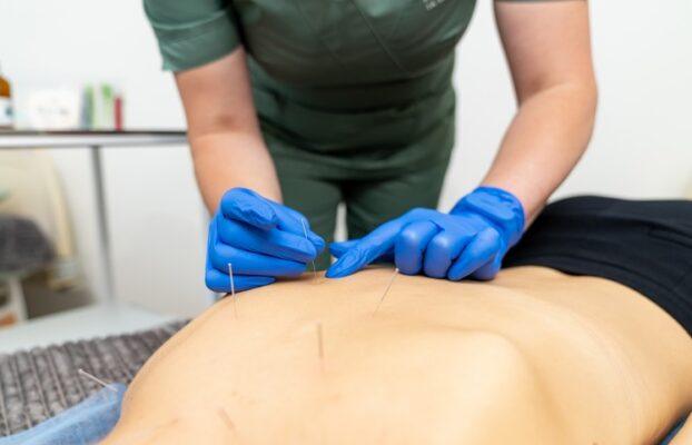 Targeting Muscle Knots: How Dry Needling Improves Movement Efficiency