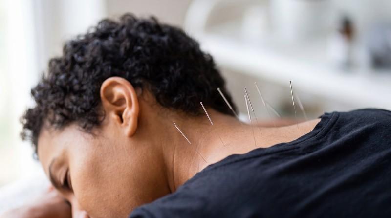 How Dry Needling Helps Treat Chronic Sports Injuries